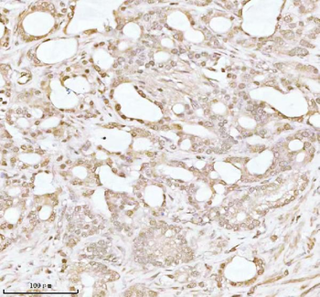PITHD1 Antibody