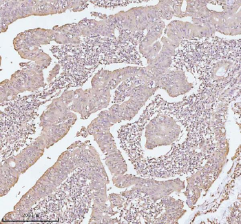PITHD1 Antibody