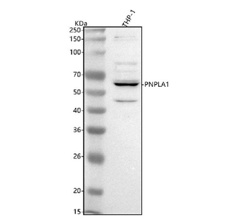PNPLA1 Rabbit Polyclonal Antibody