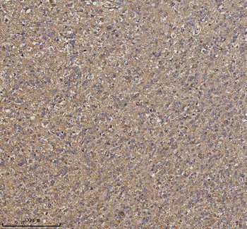 TRIM2 Rabbit Polyclonal Antibody