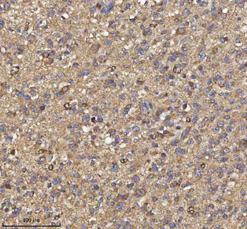 TRIM2 Rabbit Polyclonal Antibody