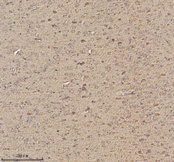 TRIM2 Rabbit Polyclonal Antibody