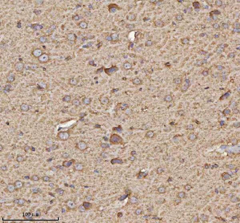 TRIM2 Rabbit Polyclonal Antibody