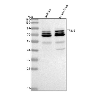 TRIM2 Rabbit Polyclonal Antibody