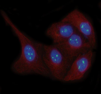 LYAR Rabbit Polyclonal Antibody