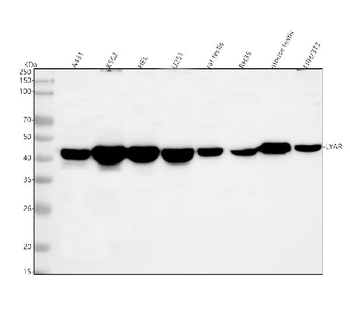 LYAR Rabbit Polyclonal Antibody