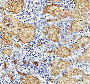 LY6D Rabbit Polyclonal Antibody