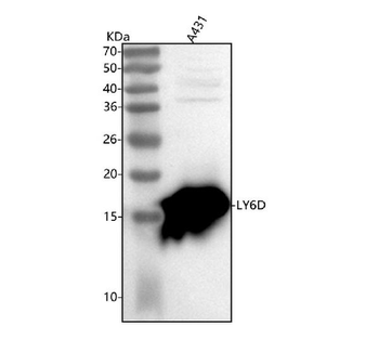 LY6D Rabbit Polyclonal Antibody