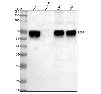LTBR Rabbit Polyclonal Antibody