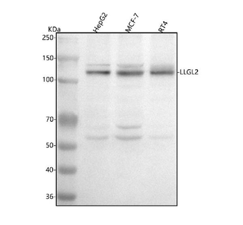 LLGL2 Rabbit Polyclonal Antibody