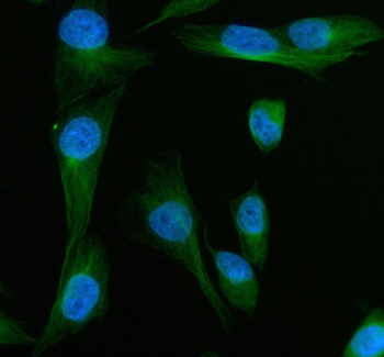 MYOT Rabbit Polyclonal Antibody