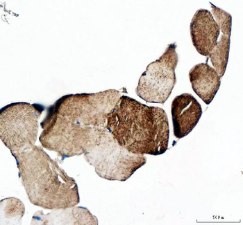 MYOT Rabbit Polyclonal Antibody
