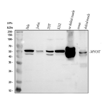 MYOT Rabbit Polyclonal Antibody