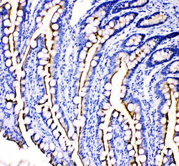 MEP1B Rabbit Polyclonal Antibody