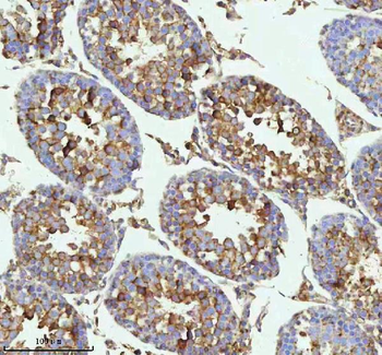 MELTF Antibody