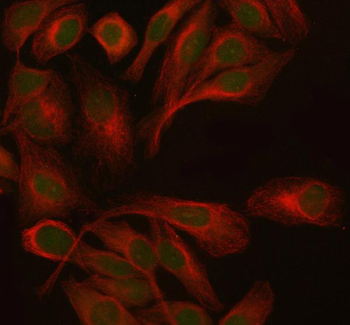 PTRHD1 Rabbit Polyclonal Antibody