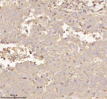 PTCD1 Antibody
