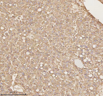 PTCD1 Antibody