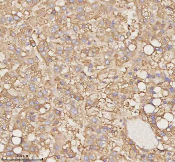 PTCD1 Antibody