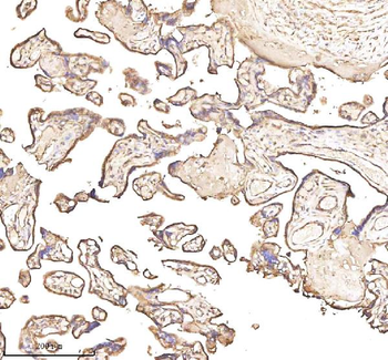 PTCD1 Antibody