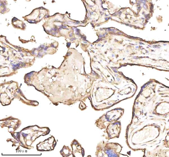 PTCD1 Antibody