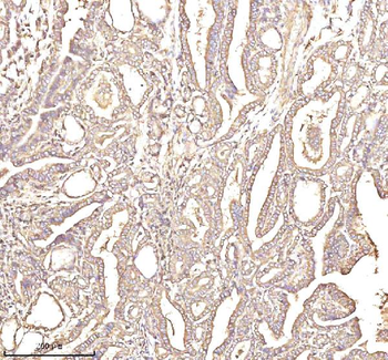PTCD1 Antibody