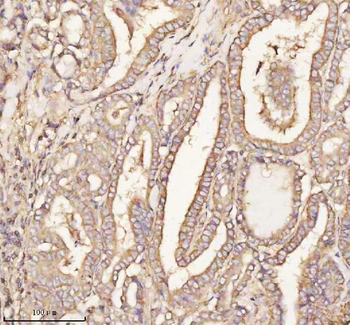 PTCD1 Antibody