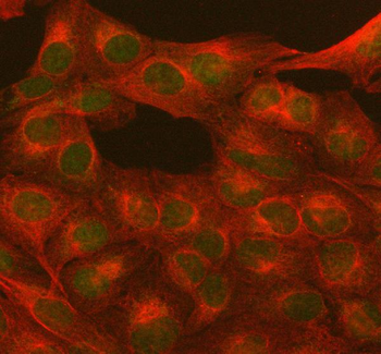 PARP1 Rabbit Polyclonal Antibody