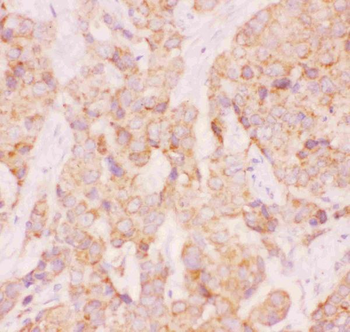 AAMP CCL18 Antibody