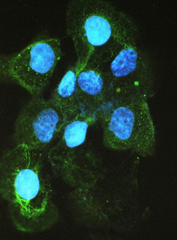 Angiotensin Converting Enzyme 1/ACE Antibody