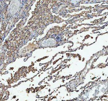 Angiotensin Converting Enzyme 1/ACE Antibody