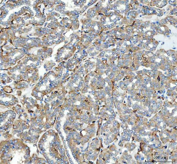 Angiotensin Converting Enzyme 1/ACE Antibody
