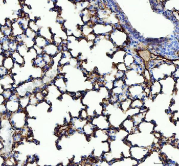 Angiotensin Converting Enzyme 1/ACE Antibody