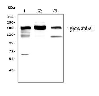 Angiotensin Converting Enzyme 1/ACE Antibody