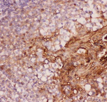 Annexin A1/ANXA1 Rabbit Polyclonal Antibody