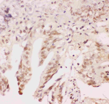 ATF1 Rabbit Polyclonal Antibody