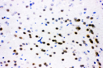 ATF2 Antibody