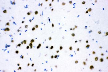 ATF2 Antibody