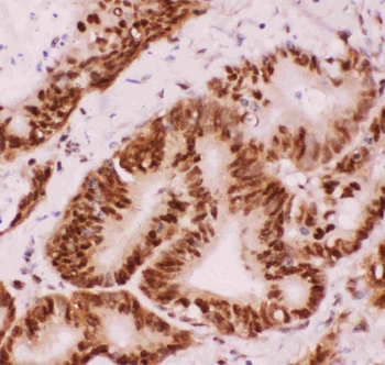 ATF2 Antibody
