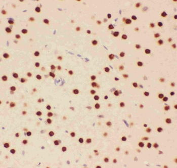 ATF2 Antibody