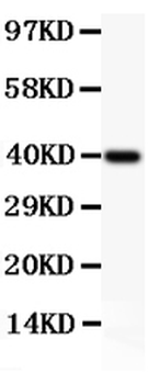MCL1 Rabbit Polyclonal Antibody