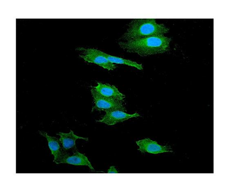 alpha 1 Catenin/CTNNA1 Rabbit Polyclonal Antibody