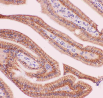 alpha 1 Catenin/CTNNA1 Rabbit Polyclonal Antibody