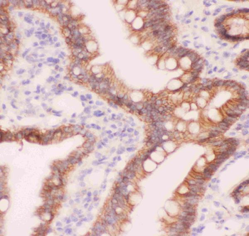 alpha 1 Catenin/CTNNA1 Rabbit Polyclonal Antibody