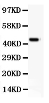 CD11b/ITGAM Antibody