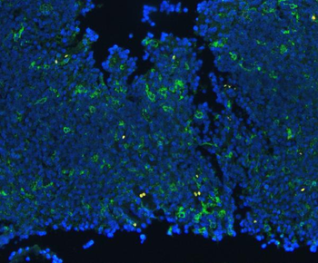CD18/ITGB2 Rabbit Polyclonal Antibody