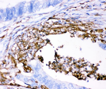 CD18/ITGB2 Rabbit Polyclonal Antibody