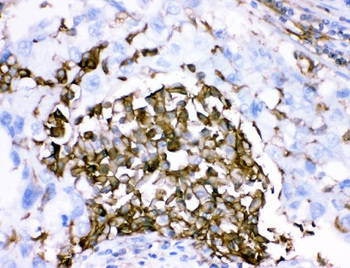 CD18/ITGB2 Rabbit Polyclonal Antibody