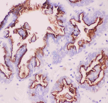 MUC1 Rabbit Polyclonal Antibody