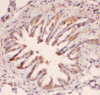 MyD88 Antibody